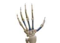 Arthrex - Compression FT Screw, 2.5 Micro, 40 mm Length - AR-8725-40H